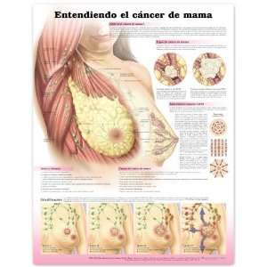  Female Breast Cancer Chart SPANISH LANGUAGE: Industrial 