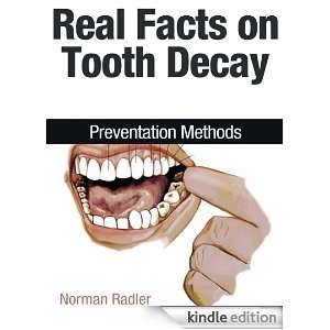 Real Facts on Tooth Decay: Preventation Methods: Norman Radler:  