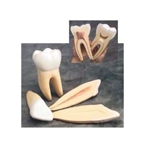  Three Teeth Model Set 