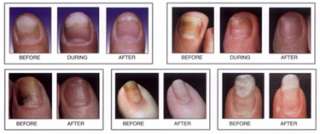 Dr. G   CLEAR NAIL Antimicrobial Solution   Kills Germs & Bacteria 