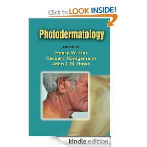 Photodermatology (Basic and Clinical Dermatology) Henry W. Lim 